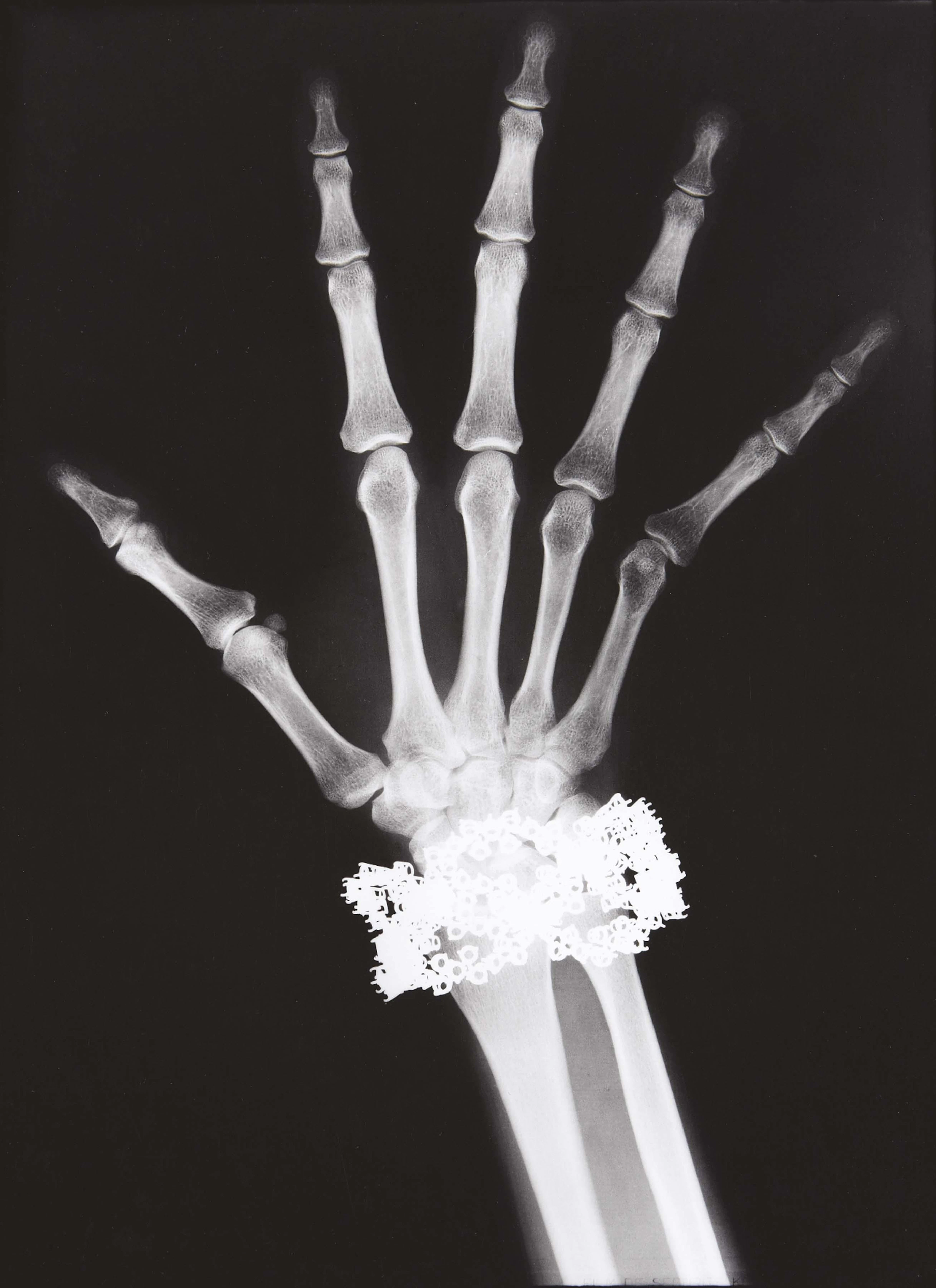 Van Cleef & Arpels Diamond Bracelet X-Ray, Paris, 1979 – Helmut Newton