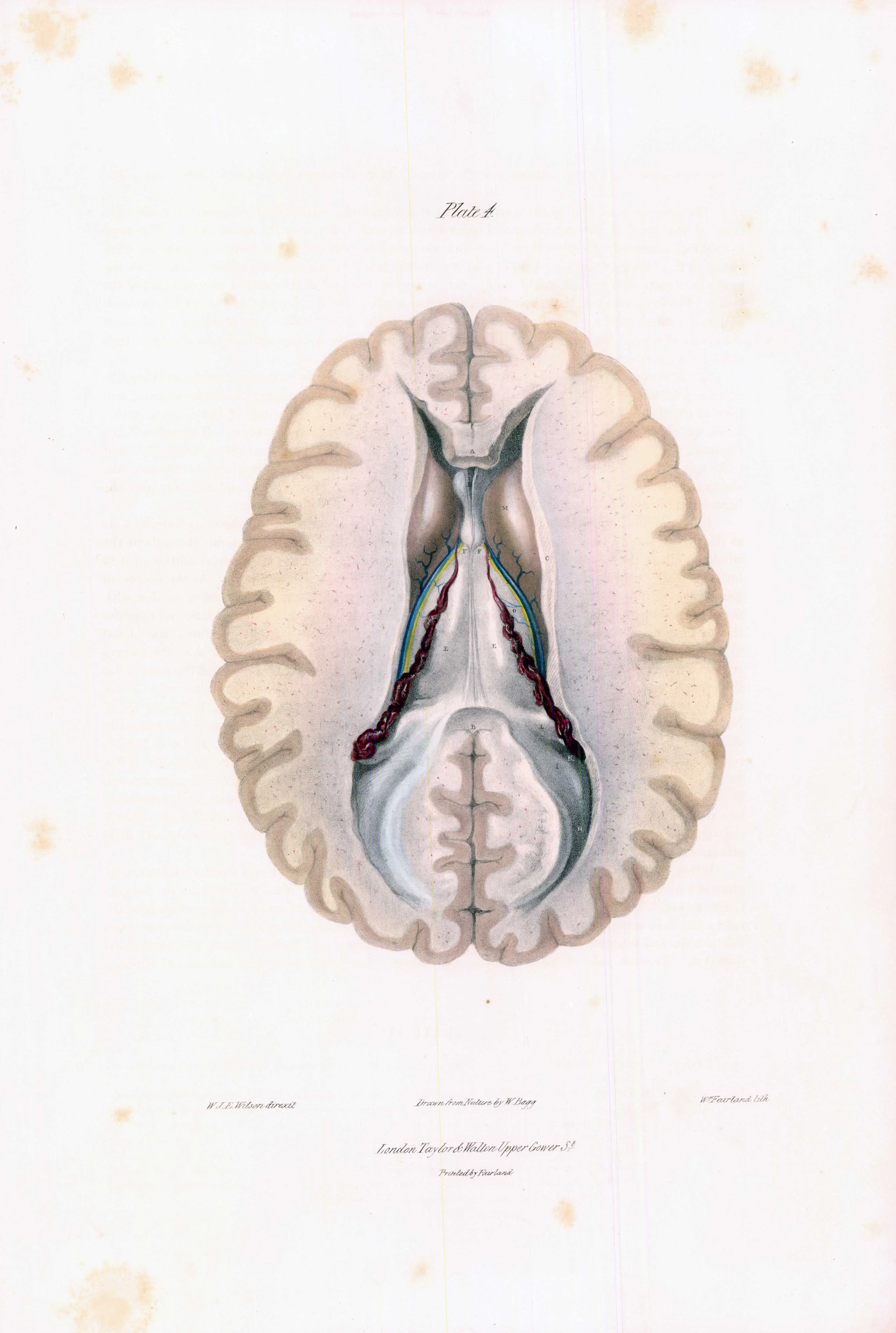 1837 Fine Antique Colour Engraving ANATOMY BRAIN SPINAL CORD (QA3-4 ...