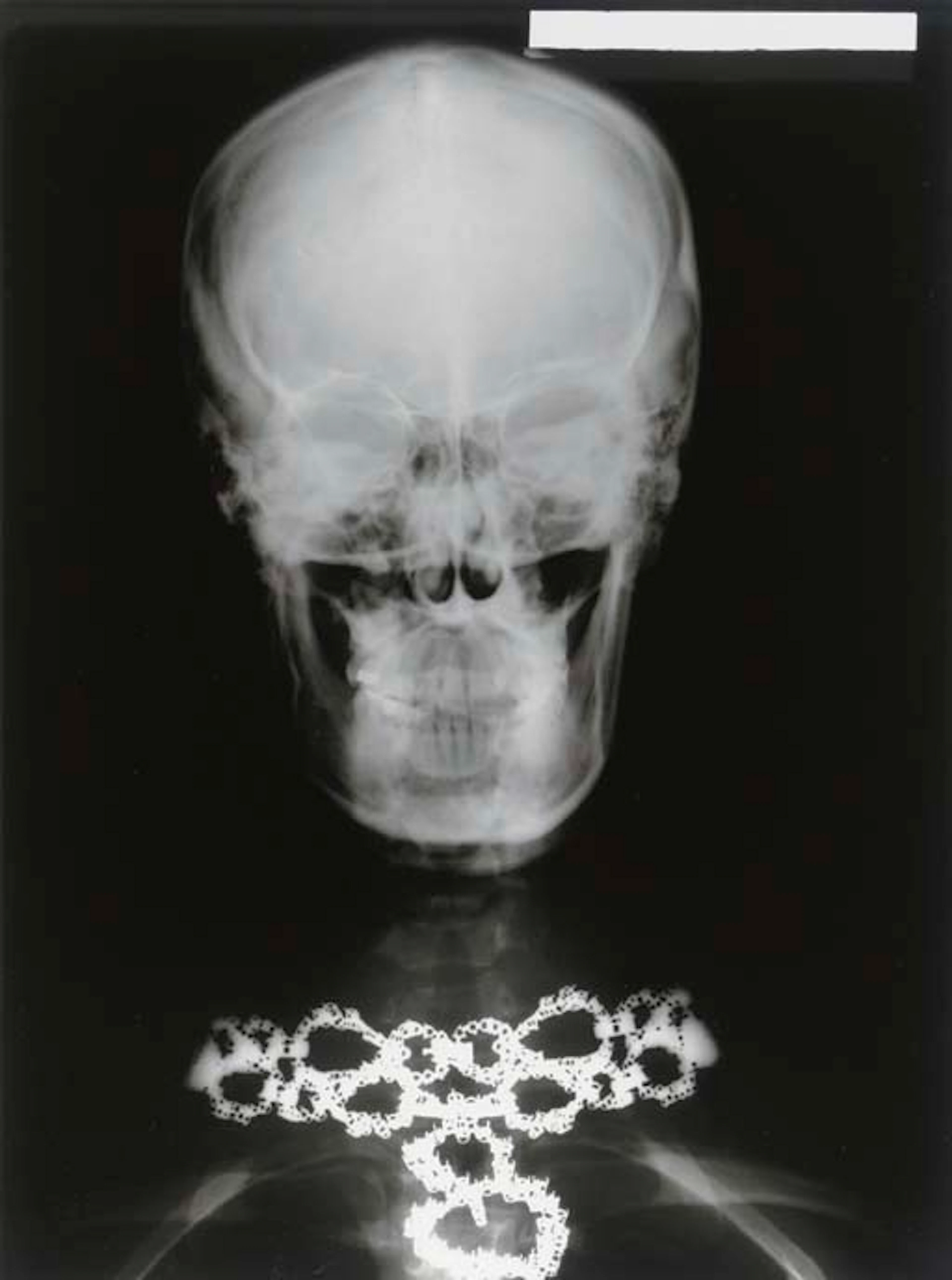 X-ray of Woman's Skull with Van Cleef and Arpels Necklace, Paris, 1979