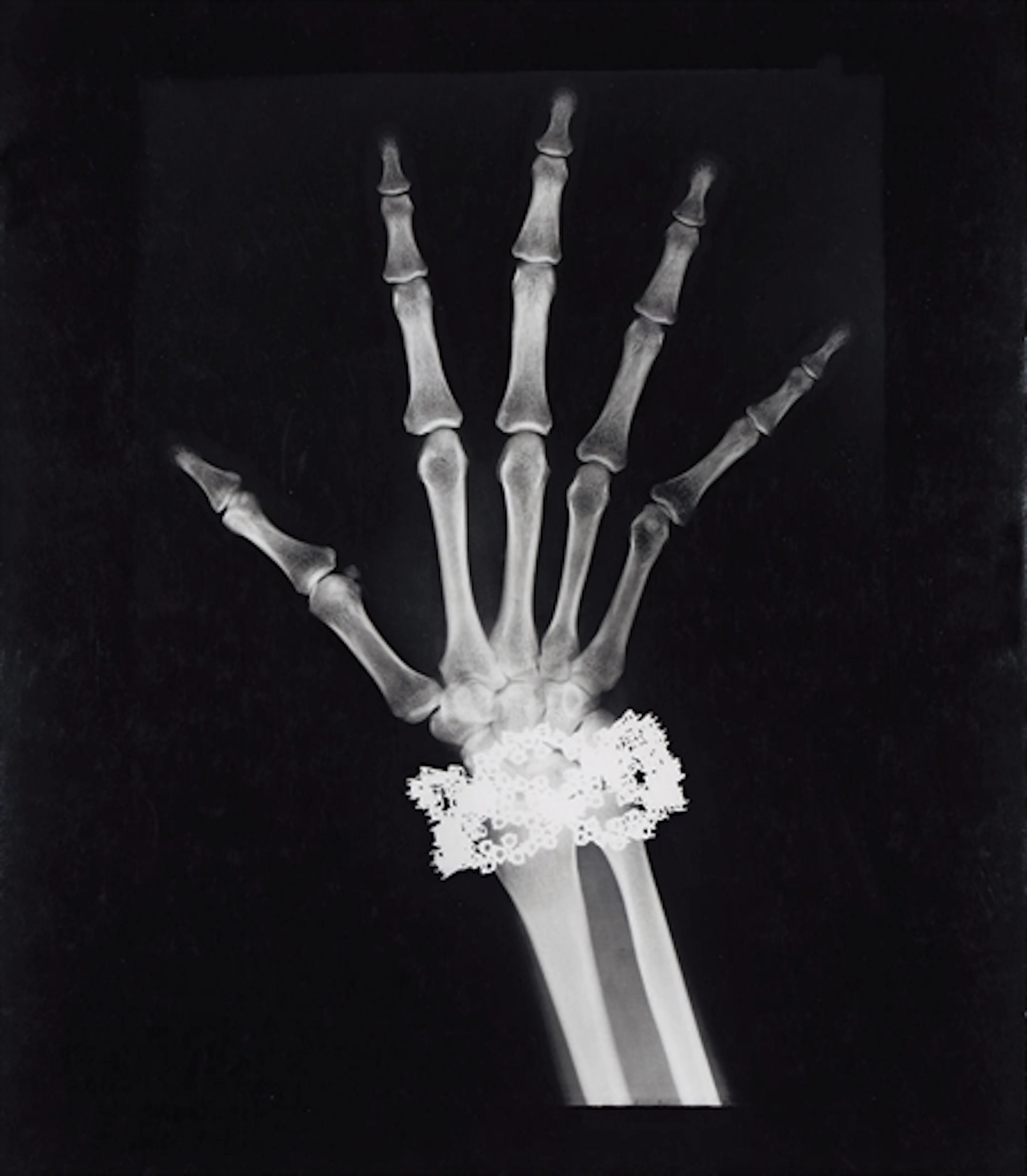 Van Cleef + Arpels Diamond Bracelet X-Ray, Paris, 1979