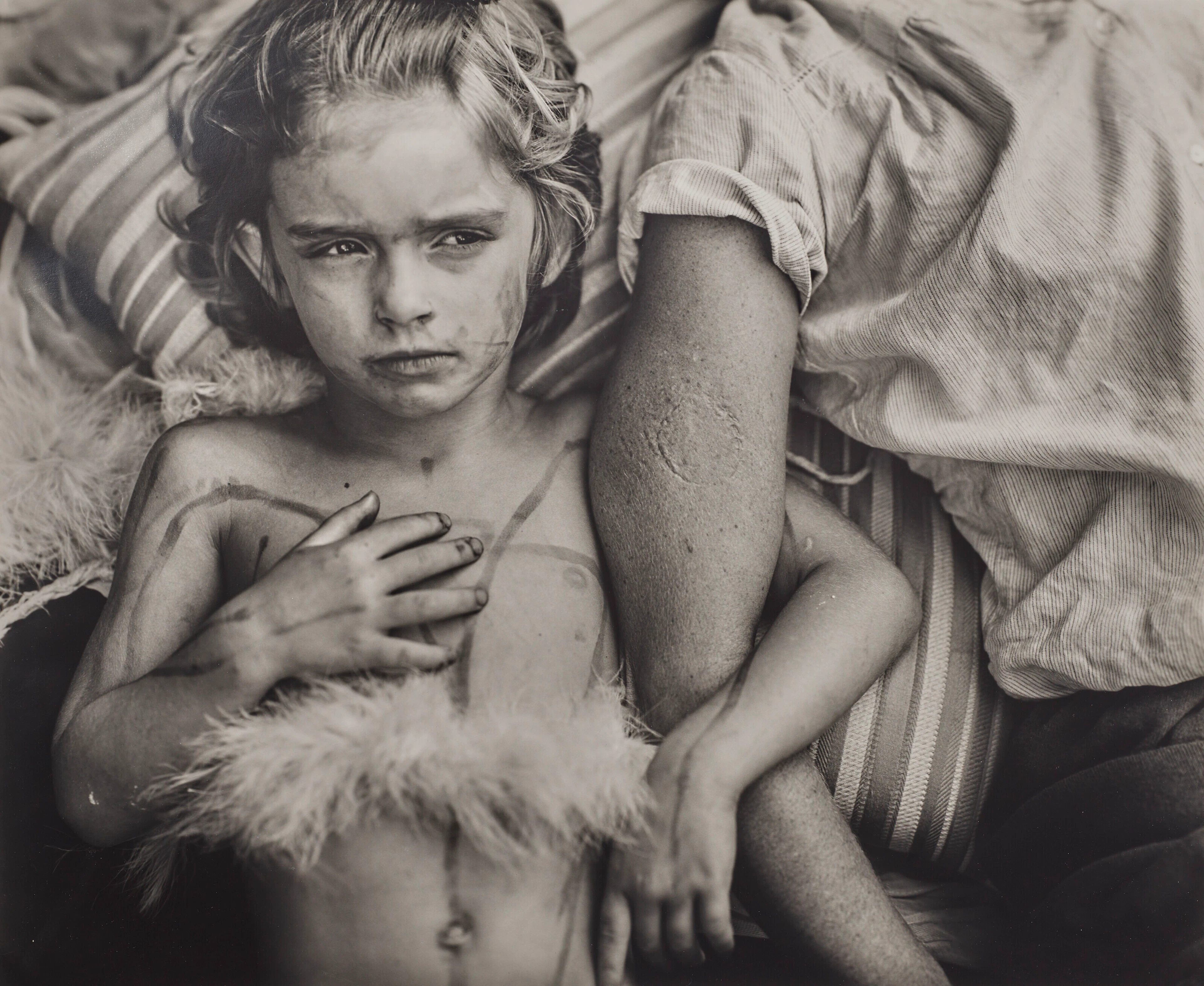 SALLY MANN (B. 1951)